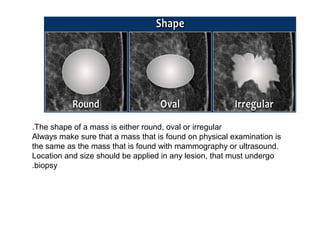 The shape of a mass is either round, oval or irregular.
Always make sure that a mass that is found on physical examination is
the same as the mass that is found with mammography or ultrasound.
Location and size should be applied in any lesion, that must undergo
biopsy.
 