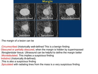 The margin of a lesion can be:
Circumscribed (historically well-defined This is a benign finding.
Obscured or partially obscured, when the margin is hidden by superimposed
fibroglandular tissue. Ultrasound can be helpful to define the margin better.
Microlobulated. This implies a suspicious finding.
Indistinct (historically ill-defined).
This is also a suspicious finding.
Spiculated with radiating lines from the mass is a very suspicious finding.
 