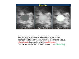 The density of a mass is related to the expected
attenuation of an equal volume of fibroglandular tissue.
High density is associated with malignancy.
It is extremely rare for breast cancer to be low density.
 