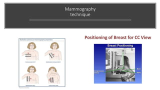 Mammography Positioning Guidebook.pdf Breast imaging.pptx