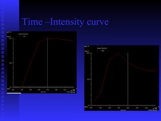 Time Intensity Model.pdf Breast imaging cases | PPT