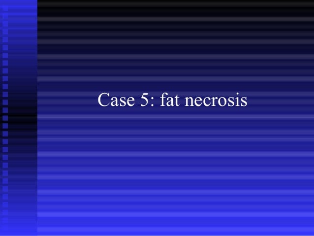 Breast Imaging Cases - 