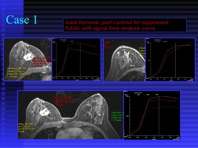 Breast Imaging Cases - 