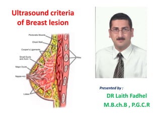 Ultrasound criteria
of Breast lesion
Presented by :
DR Laith Fadhel
M.B.ch.B , P.G.C.R
 