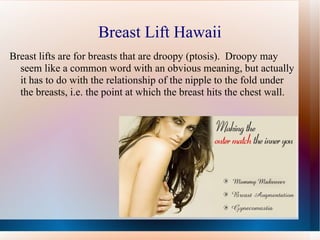 Breast Lift Hawaii
Breast lifts are for breasts that are droopy (ptosis). Droopy may
  seem like a common word with an obvious meaning, but actually
  it has to do with the relationship of the nipple to the fold under
  the breasts, i.e. the point at which the breast hits the chest wall.
 