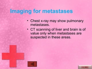 Imaging for metastases
     • Chest x-ray may show pulmonary
       metastases.
     • CT scanning of liver and brain is of
       value only when metastases are
       suspected in these areas.
 