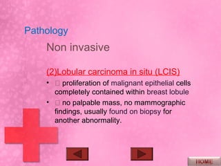 Pathology
    Non invasive

    (2)Lobular carcinoma in situ (LCIS)
    •  proliferation of malignant epithelial cells
      completely contained within breast lobule
    •  no palpable mass, no mammographic
      findings, usually found on biopsy for
      another abnormality.
 