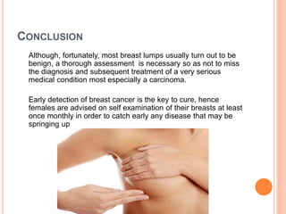 Approach to a Patient with Breast Lump