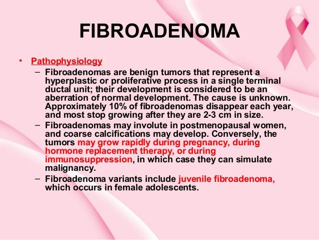 fibroadenoma of breast