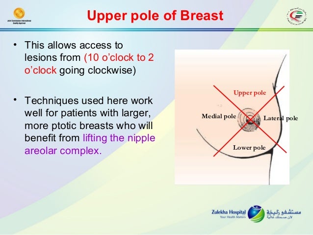 Breast Oncoplastic Surgery