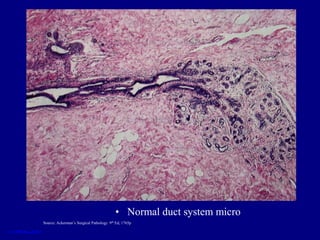 • Normal duct system micro
Source: Ackerman’s Surgical Pathology 9th Ed, 1765p
 