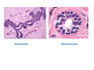Normal Acinus Breast pathology i march 15. 2015 | PPT