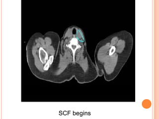 Radiotherapy in Breast Cancer: Current Issues | PPTX