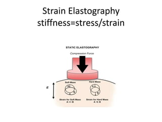 Strain Elastography
stiffness=stress/strain
 