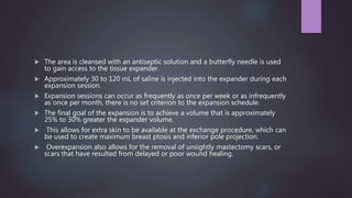  The area is cleansed with an antiseptic solution and a butterfly needle is used
to gain access to the tissue expander.
 Approximately 30 to 120 mL of saline is injected into the expander during each
expansion session.
 Expansion sessions can occur as frequently as once per week or as infrequently
as once per month, there is no set criterion to the expansion schedule.
 The final goal of the expansion is to achieve a volume that is approximately
25% to 30% greater the expander volume.
 This allows for extra skin to be available at the exchange procedure, which can
be used to create maximum breast ptosis and inferior pole projection.
 Overexpansion also allows for the removal of unsightly mastectomy scars, or
scars that have resulted from delayed or poor wound healing.
 