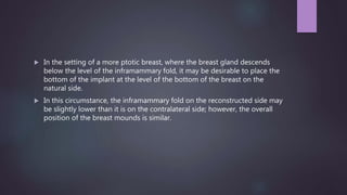  In the setting of a more ptotic breast, where the breast gland descends
below the level of the inframammary fold, it may be desirable to place the
bottom of the implant at the level of the bottom of the breast on the
natural side.
 In this circumstance, the inframammary fold on the reconstructed side may
be slightly lower than it is on the contralateral side; however, the overall
position of the breast mounds is similar.
 