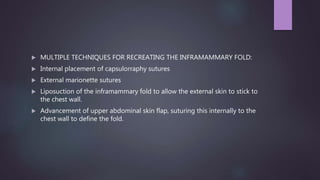  MULTIPLE TECHNIQUES FOR RECREATING THE INFRAMAMMARY FOLD:
 Internal placement of capsulorraphy sutures
 External marionette sutures
 Liposuction of the inframammary fold to allow the external skin to stick to
the chest wall.
 Advancement of upper abdominal skin flap, suturing this internally to the
chest wall to define the fold.
 