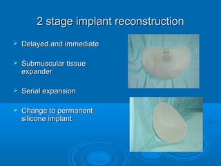 2 stage implant reconstruction2 stage implant reconstruction
 Delayed and immediateDelayed and immediate
 Submuscular tissueSubmuscular tissue
expanderexpander
 Serial expansionSerial expansion
 Change to permanentChange to permanent
silicone implantsilicone implant
 