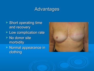 AAdvantagesdvantages
 Short operating timeShort operating time
and recoveryand recovery
 Low complication rateLow complication rate
 No donor siteNo donor site
morbiditymorbidity
 Normal appearance inNormal appearance in
clothingclothing
 