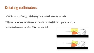 Breast site external radiation therapy.pptx