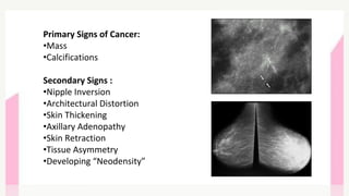 Primary Signs of Cancer:
•Mass
•Calcifications
Secondary Signs :
•Nipple Inversion
•Architectural Distortion
•Skin Thickening
•Axillary Adenopathy
•Skin Retraction
•Tissue Asymmetry
•Developing “Neodensity”
 
