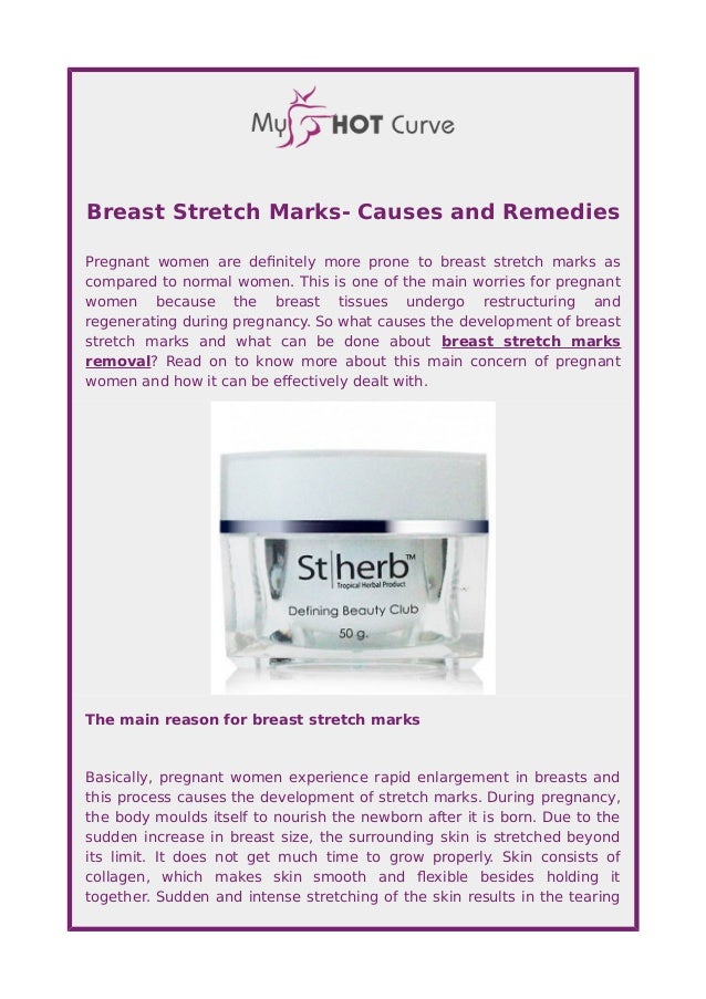 Breast Stretch Marks Causes and Remedies