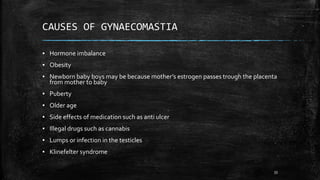 CAUSES OF GYNAECOMASTIA
▪ Hormone imbalance
▪ Obesity
▪ Newborn baby boys may be because mother’s estrogen passes trough the placenta
from mother to baby
▪ Puberty
▪ Older age
▪ Side effects of medication such as anti ulcer
▪ Illegal drugs such as cannabis
▪ Lumps or infection in the testicles
▪ Klinefelter syndrome
33
 