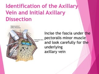 Surgical management of carcinoma breast and breast reconstruction ...