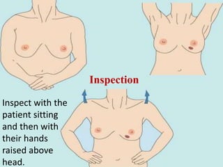Inspect with the
patient sitting
and then with
their hands
raised above
head.
Inspection
 