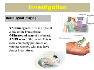 Investigation
Mammogram. This is a special
X-ray of the breast tissue.
Ultrasound scan of the breast.
MRI scan of the breast. This is
more commonly performed on
younger women, who may have
denser breast tissue.
Radiological imaging
 