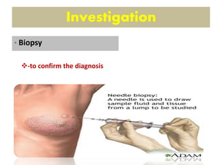 Investigation
-to confirm the diagnosis
• Biopsy
 