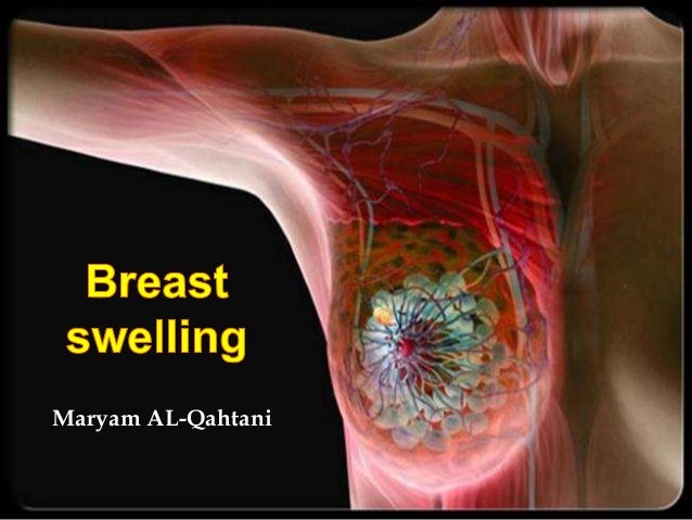 Swelling Breast 121