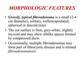 MORPHOLOGIC FEATURES
• Grossly, typical fibroadenoma is a small (2-4
cm diameter), solitary, wellencapsulated,
spherical or discoid mass
• The cut surface is firm, grey-white, slightly
myxoid and may show slitlike spaces formed
by compressed ducts
• Occasionally, multiple fibroadenomas may
form part of fibrocystic disease and is termed
fibroadenomatosis
 