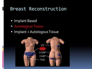 Breast Reconstruction

 Implant Based
 Autologous Tissue
 Implant + Autologous Tissue
 