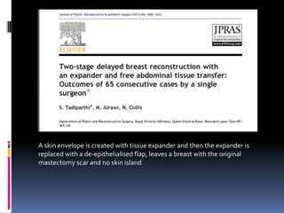 A skin envelope is created with tissue expander and then the expander is
replaced with a de-epithelialised flap, leaves a breast with the original
mastectomy scar and no skin island
 