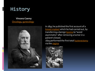 History
   Vincenz Czerny
Oncology, gynecology

                       In 1895 he published the first account of a
                       breast implant which he had carried out, by
                       transferring a benign lipoma to "avoid
                       asymmetry" after removing a tumor in a
                       patient's breast.
                       1879 performed the first total hysterectomy
                       via the vagina
 