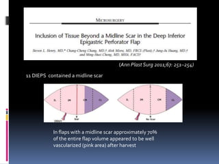 (Ann Plast Surg 2011;67: 251–254)

11 DIEPS contained a midline scar




           In flaps with a midline scar approximately 70%
           of the entire flap volume appeared to be well
           vascularized (pink area) after harvest
 