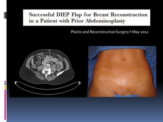 Plastic and Reconstructive Surgery • May 2012
 