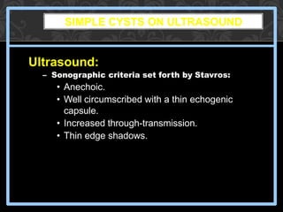 SIMPLE CYSTS ON ULTRASOUND
Ultrasound:
– Sonographic criteria set forth by Stavros:
• Anechoic.
• Well circumscribed with a thin echogenic
capsule.
• Increased through-transmission.
• Thin edge shadows.
 