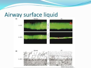 Airway surface liquid
 