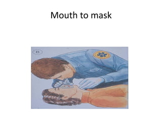 Mouth to mask
 