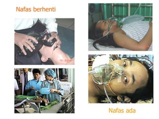 Nafas berhenti
Nafas ada
 