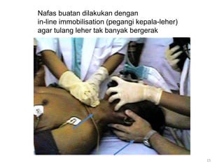 15
Nafas buatan dilakukan dengan
in-line immobilisation (pegangi kepala-leher)
agar tulang leher tak banyak bergerak
 
