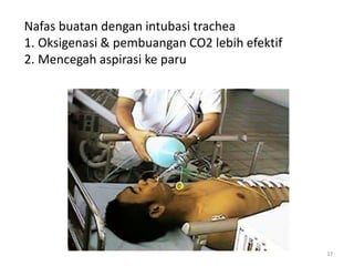 17
Nafas buatan dengan intubasi trachea
1. Oksigenasi & pembuangan CO2 lebih efektif
2. Mencegah aspirasi ke paru
 