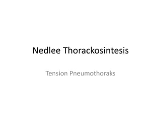 Nedlee Thorackosintesis
Tension Pneumothoraks
 