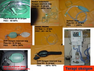 Terapi oksigen
NASAL PRONG
O2 flow 1 – 6 lpm
FiO2 : 24 – 44 %
BAG VALVE MASK (BVM)
Dgn oksigen 8-10 lpm : 60%
Masker sederhana
Dengan reservoir bag
Flow O2 : 6-10 lpm
FiO2 : 60%- 95%
BVM Dengan reservoir bag
Flow O2 : 8-10 lpm
FiO2 : 80%- 95%
Jackson Rees
Flow O2 : 8-10 lpm
FiO2 : 100%
BVM Dengan reservoir bag
Flow O2 : 8-10 lpm
FiO2 : 80%- 95%
FACE MASK O2 8-10 lpm
FiO2 : 40-60%
 