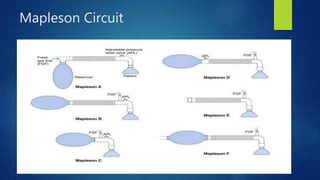Mapleson Circuit
 