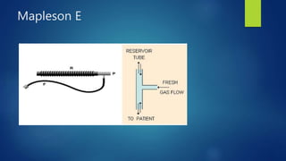 Mapleson E
 