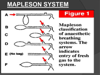 MAPLESON SYSTEM

 
