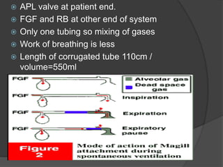 





APL valve at patient end.
FGF and RB at other end of system
Only one tubing so mixing of gases
Work of breathing is less
Length of corrugated tube 110cm /
volume=550ml

 